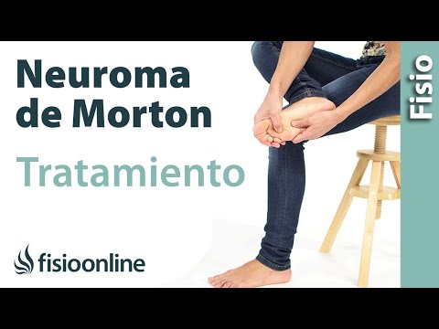 ¿Cómo tratar el Neuroma de Mortón con ejercicios: masajes y estiramientos?