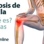 En ocasiones se me va la rodilla hacia adelante y me desequilibra ¿Qué debo hacer? En ocasiones se me va la rodilla hacia adelante y me desequilibra ¿Qué debo hacer?