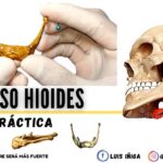 Hueso hioides Hueso hioides