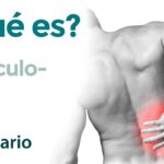 Radiculopatía Radiculopatía