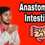 Anastomosis Anastomosis