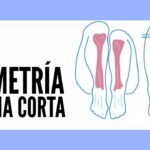 ¿La dismetría y la escoliosis pueden mejorar con la postura de la cadera? ¿Que ejercicios puedo realizar? ¿La dismetría y la escoliosis pueden mejorar con la postura de la cadera? ¿Que ejercicios puedo realizar?