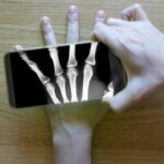 ¿Me recomiendan hacer otra radiografía de mi pie? ¿Me recomiendan hacer otra radiografía de mi pie?